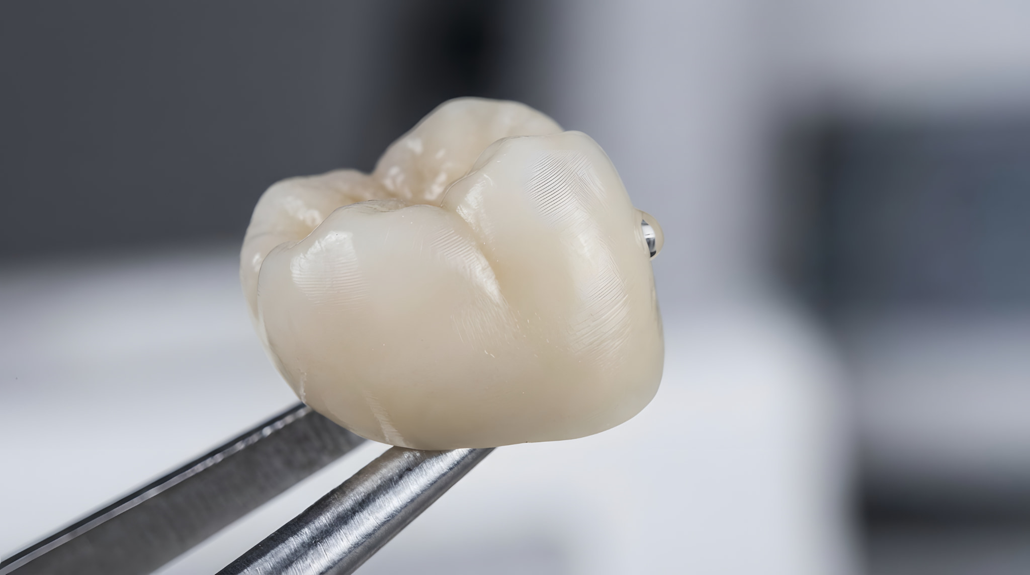 オールセラミック素材の歯